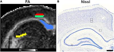 Histopathological modeling of status epilepticus-induced brain damage based on in vivo diffusion tensor imaging in rats